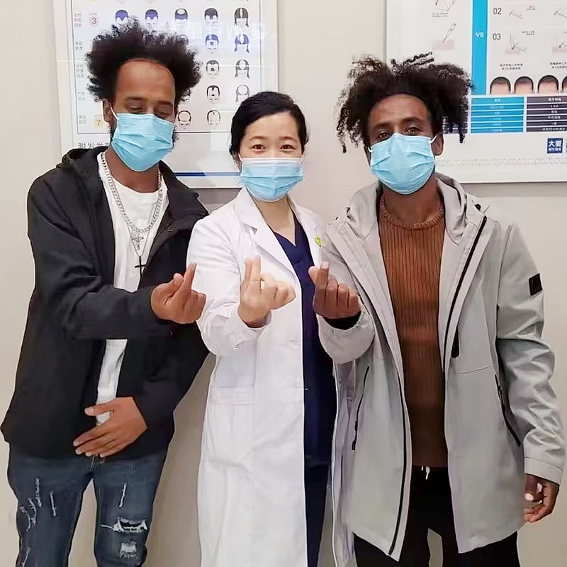 FUE patient story